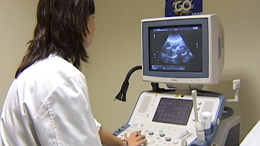 Enfermera realizando una ecografía a una embarazada