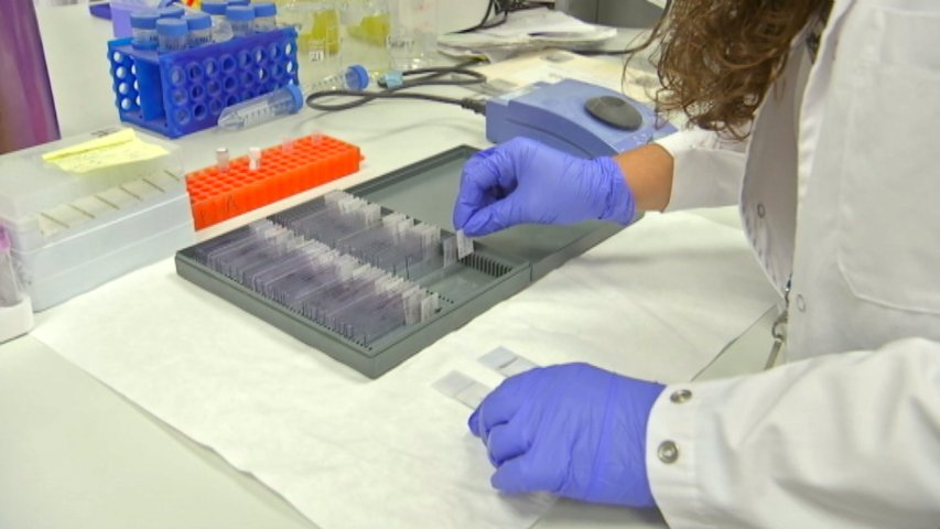 Un fármaco del Instituto de Oncología Vall d'Hebron demuestra ser eficaz contra los glioblastomas